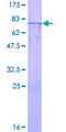 ZNF669 Protein - 12.5% SDS-PAGE of human ZNF669 stained with Coomassie Blue