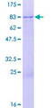 ZNF671 Protein - 12.5% SDS-PAGE of human ZNF671 stained with Coomassie Blue