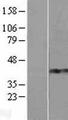 ZNF677 Protein - Western validation with an anti-DDK antibody * L: Control HEK293 lysate R: Over-expression lysate