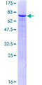 ZNF71 Protein - 12.5% SDS-PAGE of human ZNF71 stained with Coomassie Blue