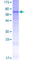 ZNF713 Protein - 12.5% SDS-PAGE of human ZNF713 stained with Coomassie Blue