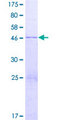 ZNF740 Protein - 12.5% SDS-PAGE of human ZNF740 stained with Coomassie Blue