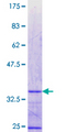 ZNF75 / ZNF75D Protein - 12.5% SDS-PAGE Stained with Coomassie Blue.