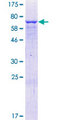 ZNF773 Protein - 12.5% SDS-PAGE of human ZNF773 stained with Coomassie Blue