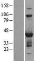 ZNF784 Protein - Western validation with an anti-DDK antibody * L: Control HEK293 lysate R: Over-expression lysate