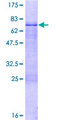 ZNF785 Protein - 12.5% SDS-PAGE of human FLJ32130 stained with Coomassie Blue