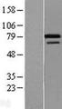 ZNF8 Protein - Western validation with an anti-DDK antibody * L: Control HEK293 lysate R: Over-expression lysate