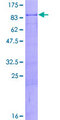 ZNF8 Protein - 12.5% SDS-PAGE of human ZNF8 stained with Coomassie Blue