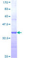 ZNF85 / HPF4 Protein - 12.5% SDS-PAGE Stained with Coomassie Blue.