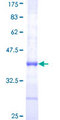 ZNF92 Protein - 12.5% SDS-PAGE Stained with Coomassie Blue.