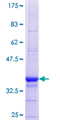 ZNHIT2 Protein - 12.5% SDS-PAGE Stained with Coomassie Blue.