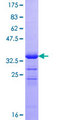ZNRD1 Protein - 12.5% SDS-PAGE of human ZNRD1 stained with Coomassie Blue