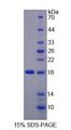 ZNRD1 Protein - Recombinant  Zinc Ribbon Domain Containing Protein 1 By SDS-PAGE