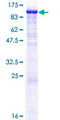 ZP2 Protein - 12.5% SDS-PAGE of human ZP2 stained with Coomassie Blue