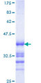 ZRANB2 / ZNF265 Protein - 12.5% SDS-PAGE Stained with Coomassie Blue.