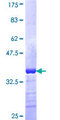 ZSCAN29 Protein - 12.5% SDS-PAGE Stained with Coomassie Blue.