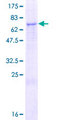 ZSWIM1 Protein - 12.5% SDS-PAGE of human ZSWIM1 stained with Coomassie Blue