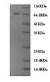 Zyxin Protein - (Tris-Glycine gel) Discontinuous SDS-PAGE (reduced) with 5% enrichment gel and 15% separation gel.