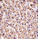 HYAL1 Antibody - HYAL1 Antibody immunohistochemistry of formalin-fixed and paraffin-embedded human liver tissue followed by peroxidase-conjugated secondary antibody and DAB staining.