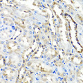 HYAL1 Antibody - Immunohistochemistry of paraffin-embedded rat kidney tissue.