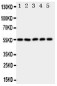 HYAL2 Antibody - Anti-HYAL2 antibody, Western blotting All lanes: Anti HYAL2 at 0.5ug/ml Lane 1: HELA Whole Cell Lysate at 40ug Lane 2: SMMC Whole Cell Lysate at 40ug Lane 3: COLO320 Whole Cell Lysate at 40ug Lane 4: MCF-7 Whole Cell Lysate at 40ug Lane 5: HT1080 Whole Cell Lysate at 40ug Predicted bind size: 54KD Observed bind size: 54KD