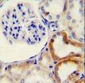 HYAL2 Antibody - HYAL2 Antibody immunohistochemistry of formalin-fixed and paraffin-embedded human kidney tissue followed by peroxidase-conjugated secondary antibody and DAB staining.