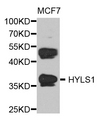HYLS1 Antibody - Western blot analysis of extract of various cells.