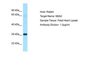 Hypothetical Protein / TINP1 Antibody -  This image was taken for the unconjugated form of this product. Other forms have not been tested.