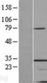 Hypothetical Protein / TINP1 Protein - Western validation with an anti-DDK antibody * L: Control HEK293 lysate R: Over-expression lysate