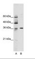 HZF16 / ZNF124 Antibody - A: Marker, B: Jurkat Cell Lysate.  This image was taken for the unconjugated form of this product. Other forms have not been tested.