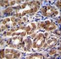 I-FABP / FABP2 Antibody - FABP2 Antibody immunohistochemistry of formalin-fixed and paraffin-embedded human stomach tissue followed by peroxidase-conjugated secondary antibody and DAB staining.