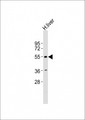 IA-6 / INSM2 Antibody - Anti-INSM2 Antibody at 1:1000 dilution + human liver lysates Lysates/proteins at 20 ug per lane. Secondary Goat Anti-Rabbit IgG, (H+L), Peroxidase conjugated at 1/10000 dilution Predicted band size : 59 kDa Blocking/Dilution buffer: 5% NFDM/TBST.