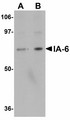 IA-6 / INSM2 Antibody - Western blot of IA-6 in rat thymus tissue lysate with IA-6 antibody at (A) 1 and (B) 2 ug/ml.