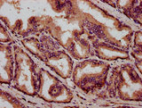 IBA57 / C1orf69 Antibody - Immunohistochemistry Dilution at 1:400 and staining in paraffin-embedded human prostate tissue performed on a Leica BondTM system. After dewaxing and hydration, antigen retrieval was mediated by high pressure in a citrate buffer (pH 6.0). Section was blocked with 10% normal Goat serum 30min at RT. Then primary antibody (1% BSA) was incubated at 4°C overnight. The primary is detected by a biotinylated Secondary antibody and visualized using an HRP conjugated SP system.