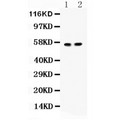 ICA69 / ICA1 Antibody - ICA1 antibody Western blot. All lanes: Anti ICA1 at 0.5 ug/ml. Lane 1: Rat Brain Tissue Lysate at 50 ug. Lane 2: Mouse Pancreas Tissue Lysate at 50 ug. Predicted band size: 55 kD. Observed band size: 55 kD.