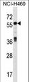 ICA69 / ICA1 Antibody - ICA1 Antibody western blot of NCI-H460 cell line lysates (35 ug/lane). The ICA1 antibody detected the ICA1 protein (arrow).