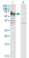 ICA69 / ICA1 Antibody - Western Blot analysis of ICA1 expression in transfected 293T cell line by ICA1 monoclonal antibody (M01), clone 6G11.Lane 1: ICA1 transfected lysate (Predicted MW: 54.6 KDa).Lane 2: Non-transfected lysate.