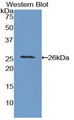 ICAM4 / CD242 Antibody - Western blot of recombinant ICAM4 / CD242.