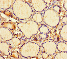 ICE1 Antibody - Immunohistochemistry of paraffin-embedded human thyroid tissue at dilution of 1:100