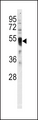ICSBP / IRF8 Antibody - Western blot of anti-IRF8 Antibody in HL60 cell line lysates (35 ug/lane). IRF8 (arrow) was detected using the purified antibody.