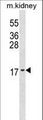 ID3 Antibody - ID3 Antibody western blot of mouse kidney tissue lysates (35 ug/lane). The ID3 antibody detected the ID3 protein (arrow).