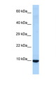 ID3 Antibody - ID3 antibody Western blot of Rat Liver lysate. Antibody concentration 1 ug/ml.  This image was taken for the unconjugated form of this product. Other forms have not been tested.