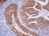 IDH1 / IDH Antibody - IHC of paraffin-embedded Human endometrium tissue using anti-IDH1 mouse monoclonal antibody. (Heat-induced epitope retrieval by 10mM citric buffer, pH6.0, 100C for 10min).