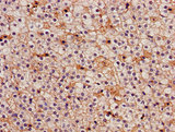IDH3A Antibody - Immunohistochemistry image of paraffin-embedded human adrenal gland tissue at a dilution of 1:100