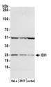 IDI1 / IPP1 Antibody - Detection of human IDI1 by western blot. Samples: Whole cell lysate (50 µg) from HeLa, HEK293T, and Jurkat cells prepared using NETN lysis buffer. Antibody: Affinity purified rabbit anti-IDI1 antibody used for WB at 0.1 µg/ml. Detection: Chemiluminescence with an exposure time of 30 seconds.