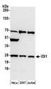 IDI1 / IPP1 Antibody - Detection of human IDI1 by western blot. Samples: Whole cell lysate (50 µg) from HeLa, HEK293T, and Jurkat cells prepared using NETN lysis buffer. Antibody: Affinity purified rabbit anti-IDI1 antibody used for WB at 0.4 µg/ml. Detection: Chemiluminescence with an exposure time of 30 seconds.