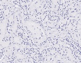 IDN3 / NIPBL Antibody - NIPBL (aa889-902) Antibody Negative Control showing staining of paraffin embedded Human Cerebellum, with no primary antibody.