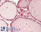 IDO2 / INDOL1 Antibody - Human Thyroid: Formalin-Fixed, Paraffin-Embedded (FFPE)