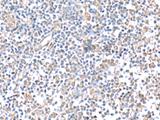 IFI27 / p27 Antibody - Immunohistochemistry of paraffin-embedded Human tonsil tissue  using IFI27 Polyclonal Antibody at dilution of 1:80(×200)