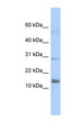 IFI27L2 Antibody - IFI27L2 / FAM14A antibody Western blot of Transfected 293T cell lysate. This image was taken for the unconjugated form of this product. Other forms have not been tested.
